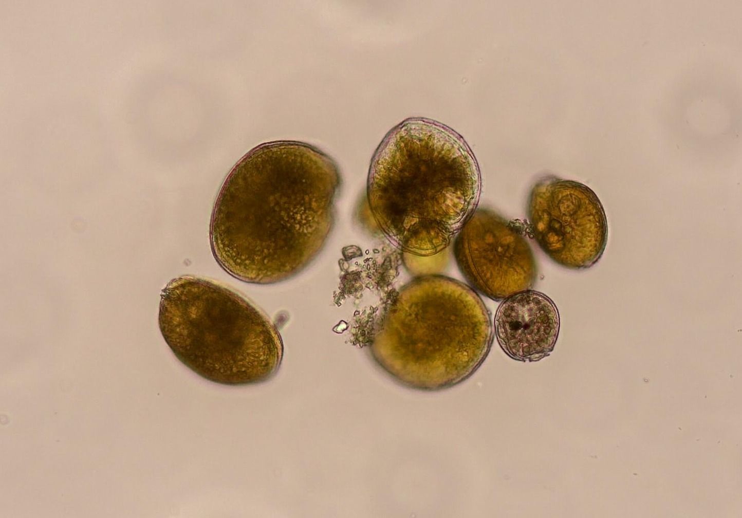 Imatge de laboratori de la microalga 'Gambierdiscus Australs' detectada a Alacant