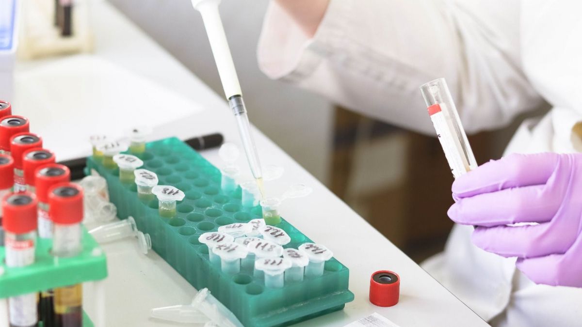 Anàlisi de proves diagnòstiques mèdiques en un laboratori Anàlisi de proves diagnòstiques mèdiques en un laboratori